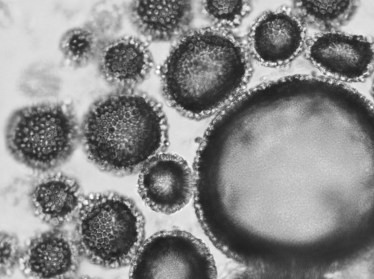 yeast templated air bubbles