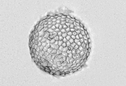 gel core colloidosomes3